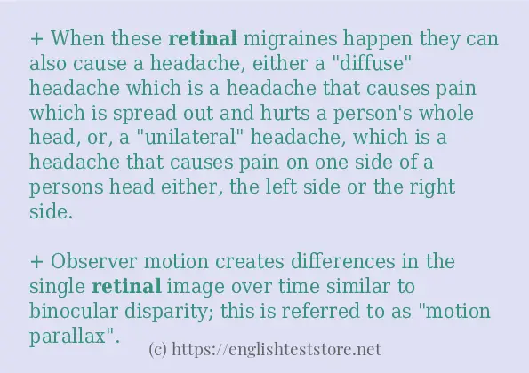 Sentence example of retinal