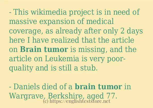 Some in-sentence examples of brain tumor