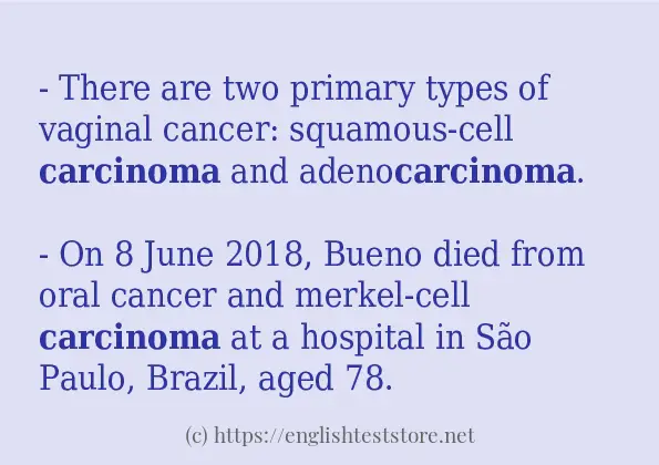 Some in-sentence examples of carcinoma