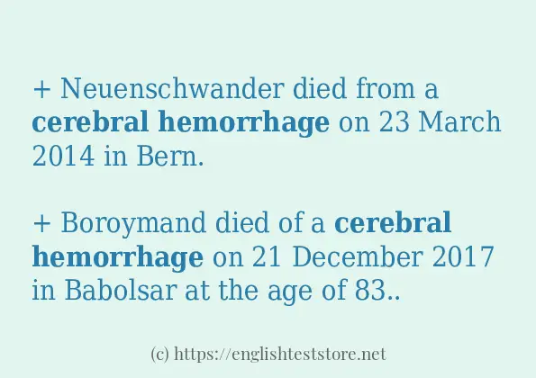 cerebral hemorrhage example in sentences